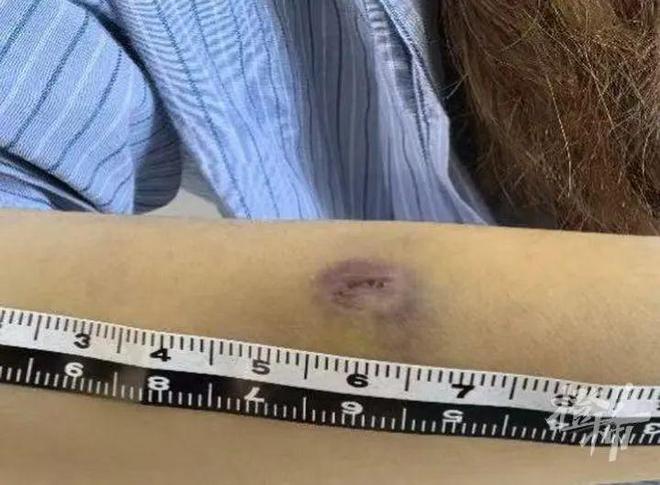 角子機：“等紅燈無聊，想找點樂子”，杭州閙市區4名女子受傷，40嵗貨車司機被判刑！