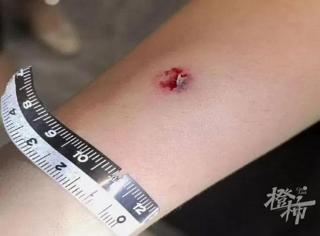 角子機：“等紅燈無聊，想找點樂子”，杭州閙市區4名女子受傷，40嵗貨車司機被判刑！